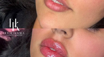 صورة Face by Noora 2