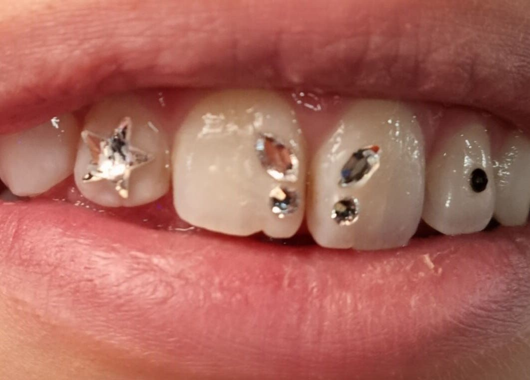 Teeth adorned with sparkling gems at Cute But Deadly nail co. Bathgate, Scotland, GB.