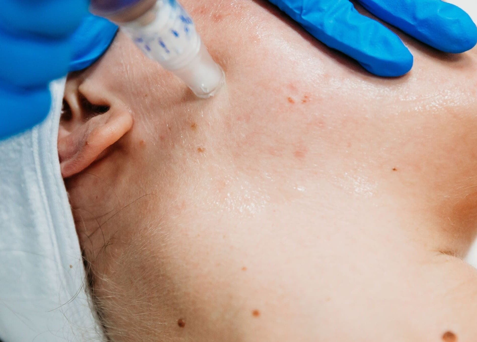 Facial treatment at Vogue Lashes & Spa - Great Bridge in Chesapeake, Virginia, US. Skincare in progress.