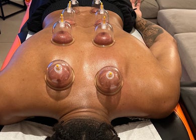 Cupping therapy in action at The Body Massage Guru, Manchester, England, GB.