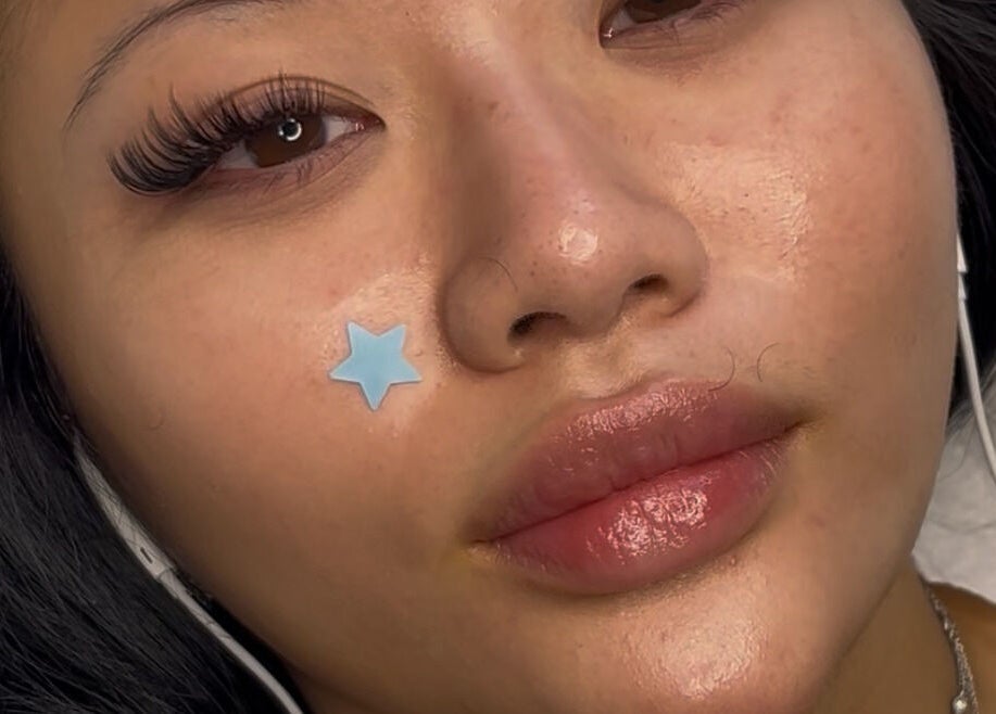 Close-up of a client's face with glowing skin and a star pimple patch at Deebeautystop, London, England, GB.