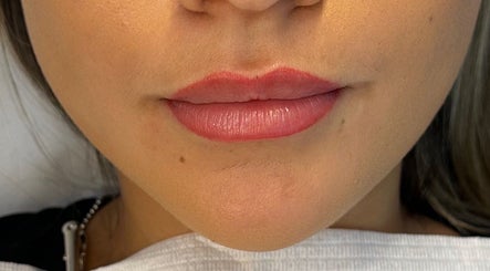 Close-up of enhanced lips at Amavi Aesthetics, Kingston Upon Thames, England, GB, showcasing beauty treatment.