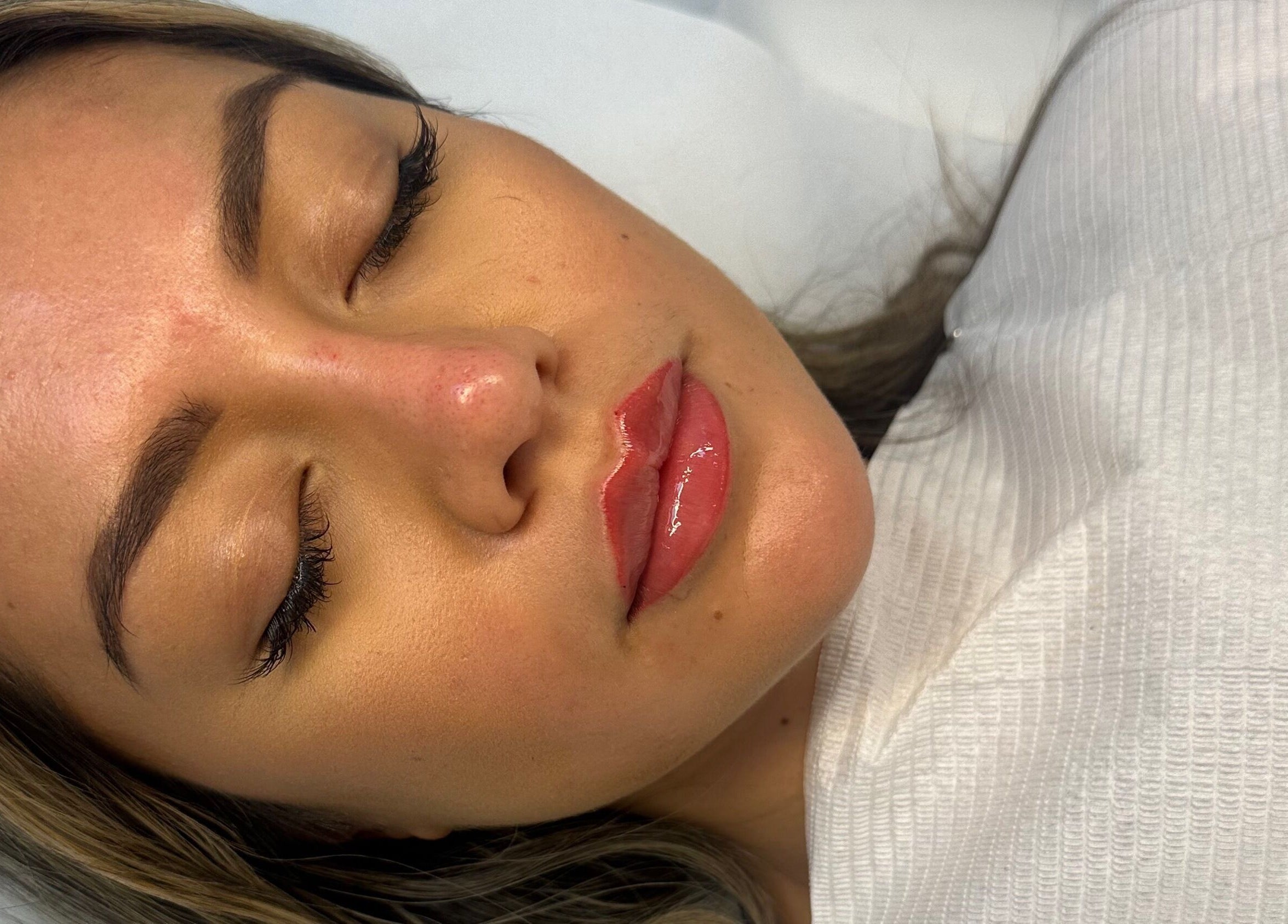 Close-up of a peaceful face after treatment at Amavi Aesthetics, Kingston Upon Thames, England, GB.