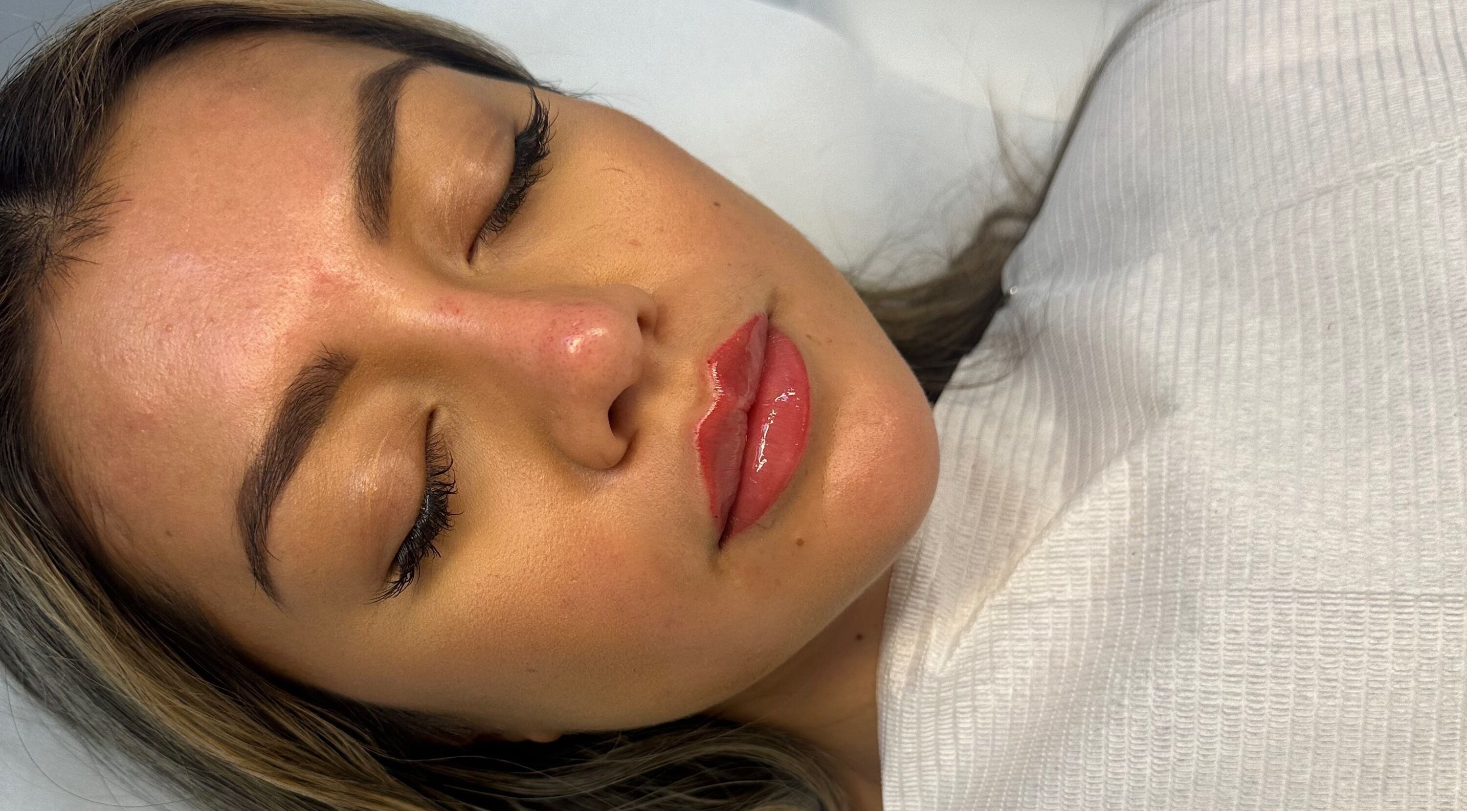 Close-up of a peaceful face after treatment at Amavi Aesthetics, Kingston Upon Thames, England, GB.