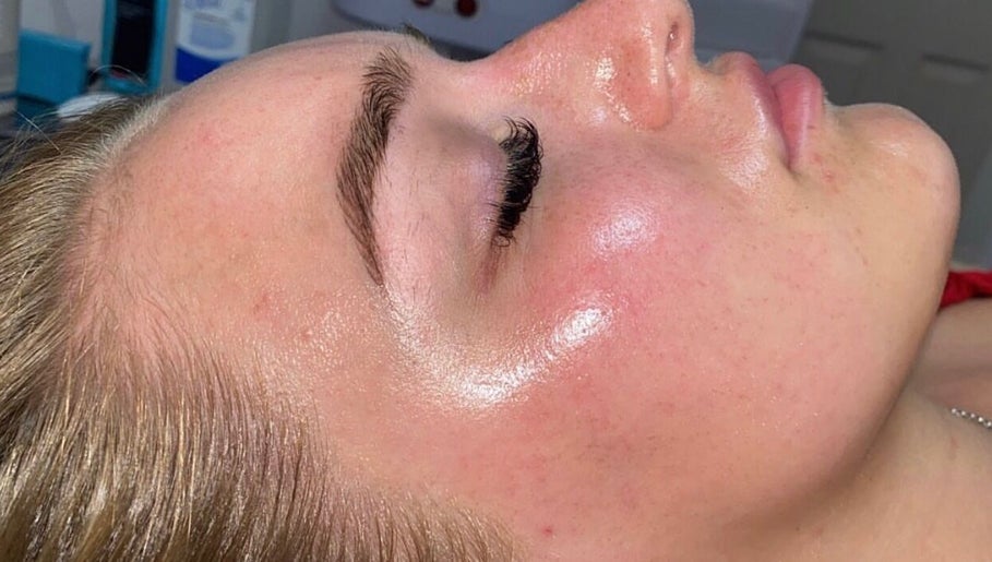 The Skin Place. image 1