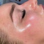 The Skin Place. - Amy Johnson Way, Block A, Unit 6, Blackpool Business Park, Blackpool, England