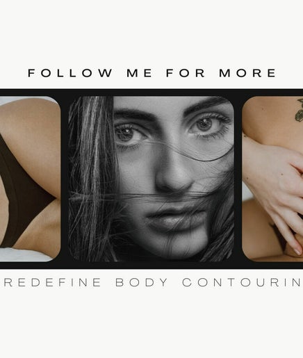 Redefine Body Contouring image 2