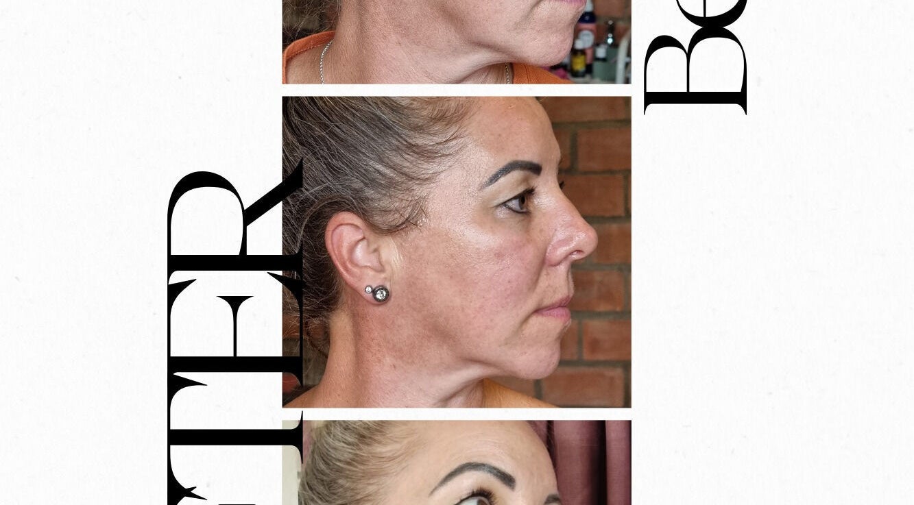 Before and after skin enhancement at Pretty Pamper, Jeffreys Bay, Eastern Cape, ZA.