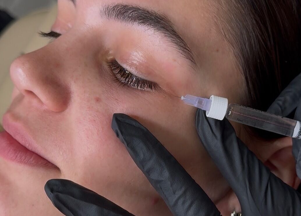 Facial treatment at Aesthetixx, Coburg North, Victoria, AU, showcasing precise skincare application.