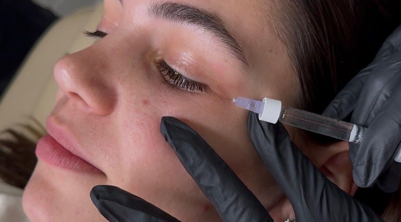 Facial treatment at Aesthetixx, Coburg North, Victoria, AU, showcasing precise skincare application.