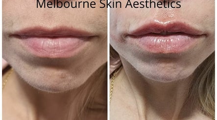 Melbourne Skin Aesthetics imaginea 3