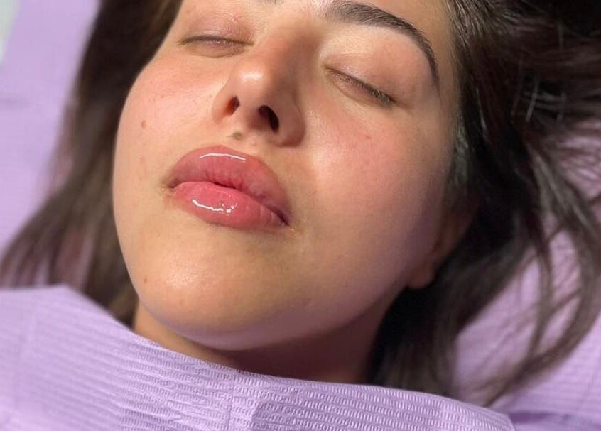 Close-up of a woman with glossy lips at Beauty Innovation, Colchester, England, GB, showcasing skincare treatment.