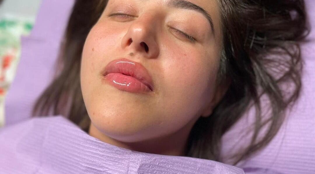 Close-up of a woman with glossy lips at Beauty Innovation, Colchester, England, GB, showcasing skincare treatment.