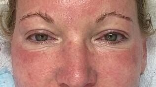 Xtreme Facials Warrenville