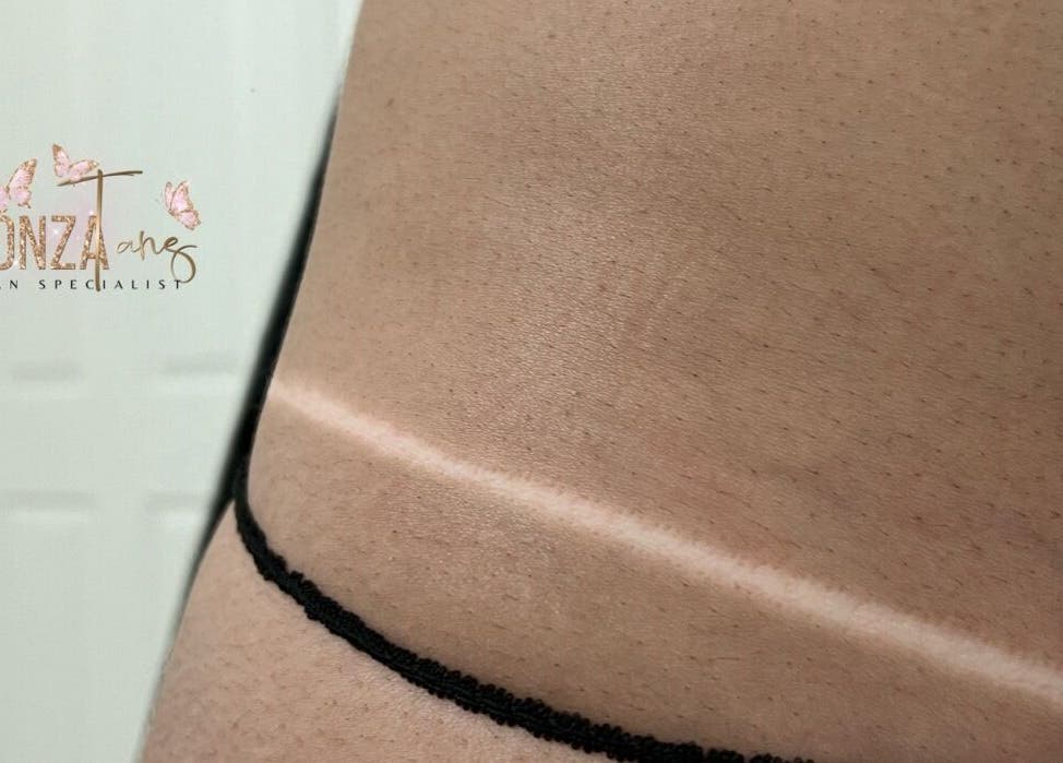 Natural tan lines showcased at Bronza, Warrnambool, Victoria, AU. Highlighting expert tanning services.
