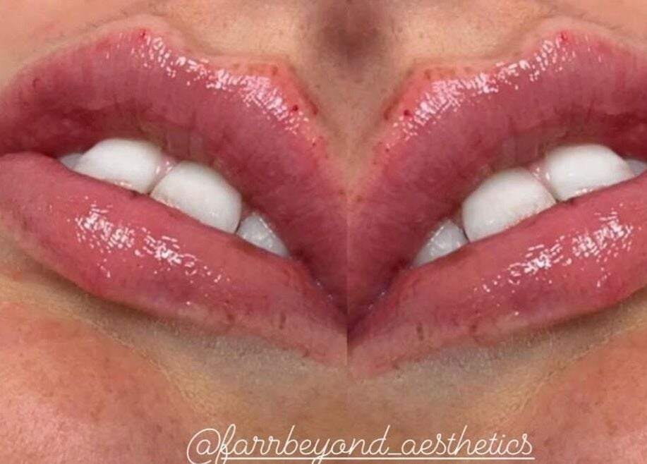 Close-up of glossy lips with a smooth finish at Farr Beyond Aesthetics, Plymouth, England, GB.