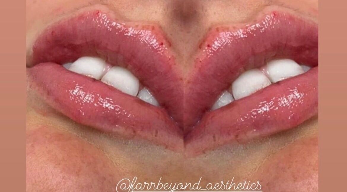 Close-up of glossy lips with a smooth finish at Farr Beyond Aesthetics, Plymouth, England, GB.