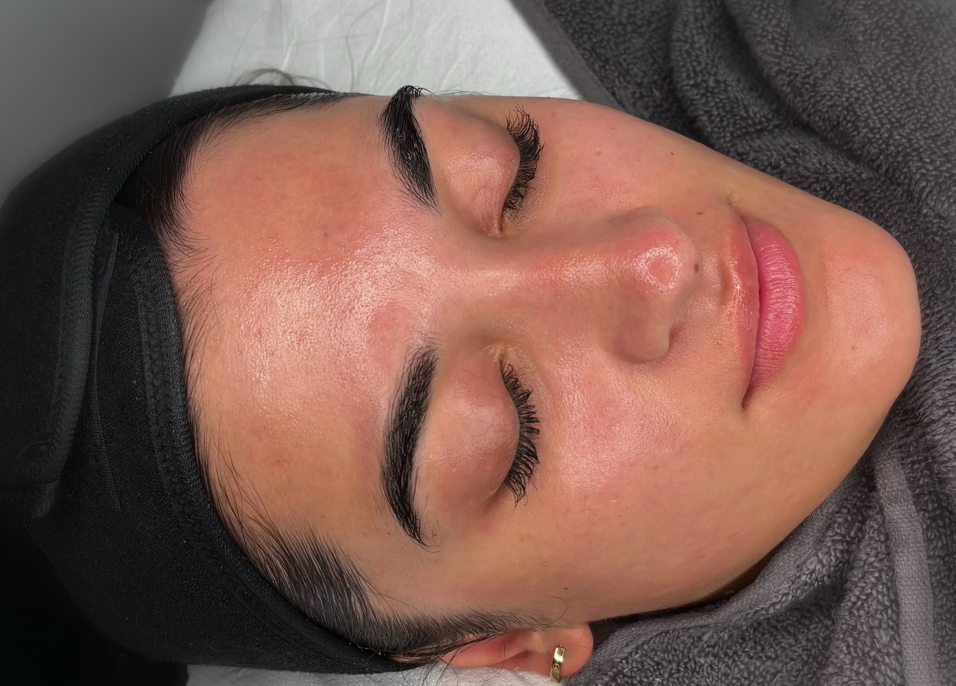 Client enjoying facial treatment at HB Aesthetics, Cannock, England, GB.