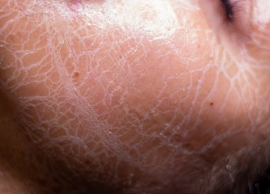 Closeup of radiant skin detail at G Beauty Place, Perth, Scotland, GB showcasing texture and tone.