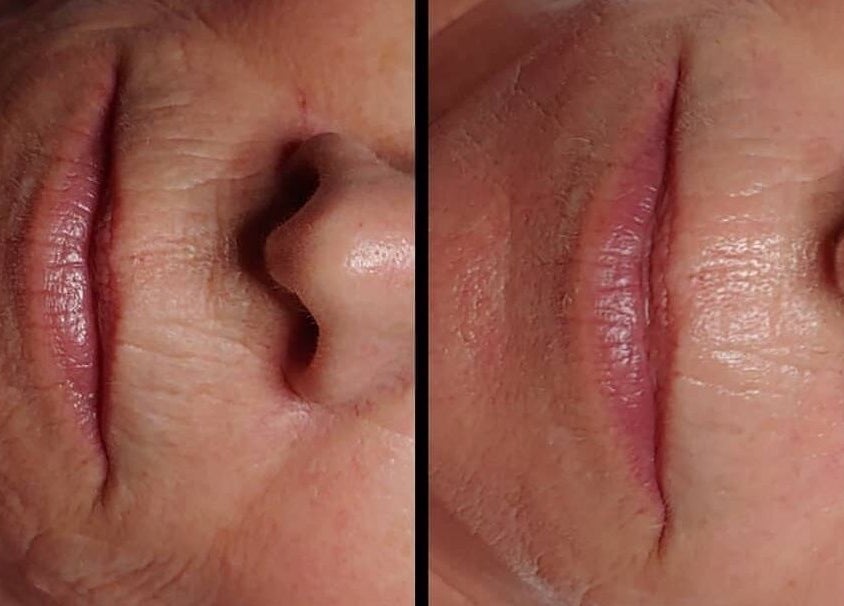 Before and after skincare results at Vivu Lash & Skin in Tucson, Arizona, US, showcasing rejuvenated skin.