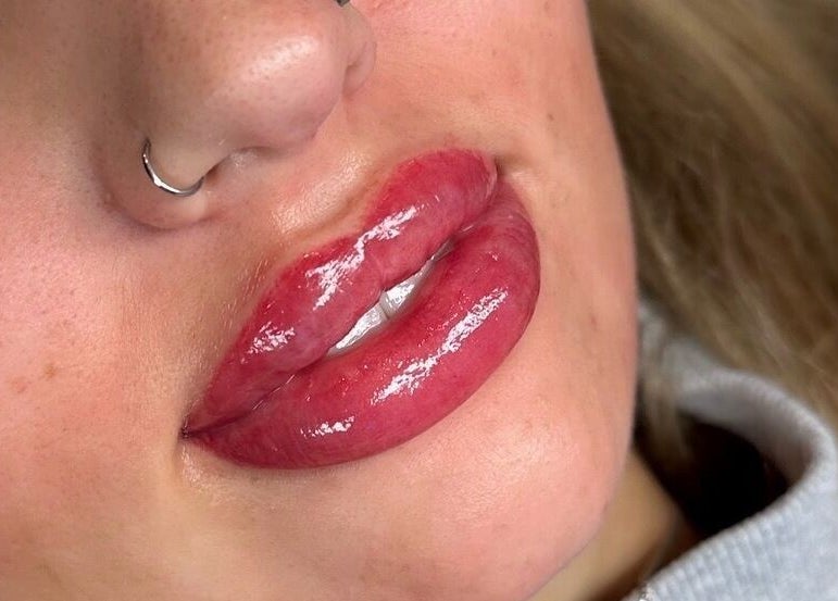 Glossy, enhanced lips at The Glow Hub in Black Notley, England, GB, showcase beauty treatment results.