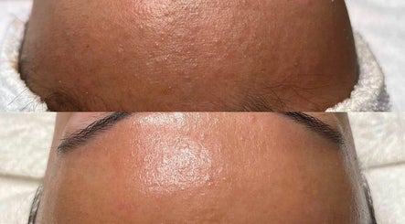 MF Skin and Laser Clinic, bild 3