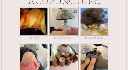 Lotus Acupuncture & Massage Clinic, bilde 2