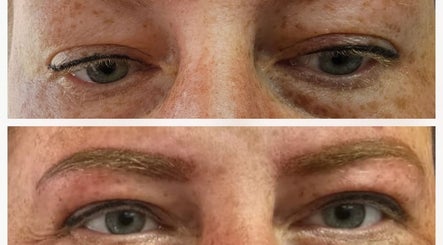 Skin-Finity Bild 2