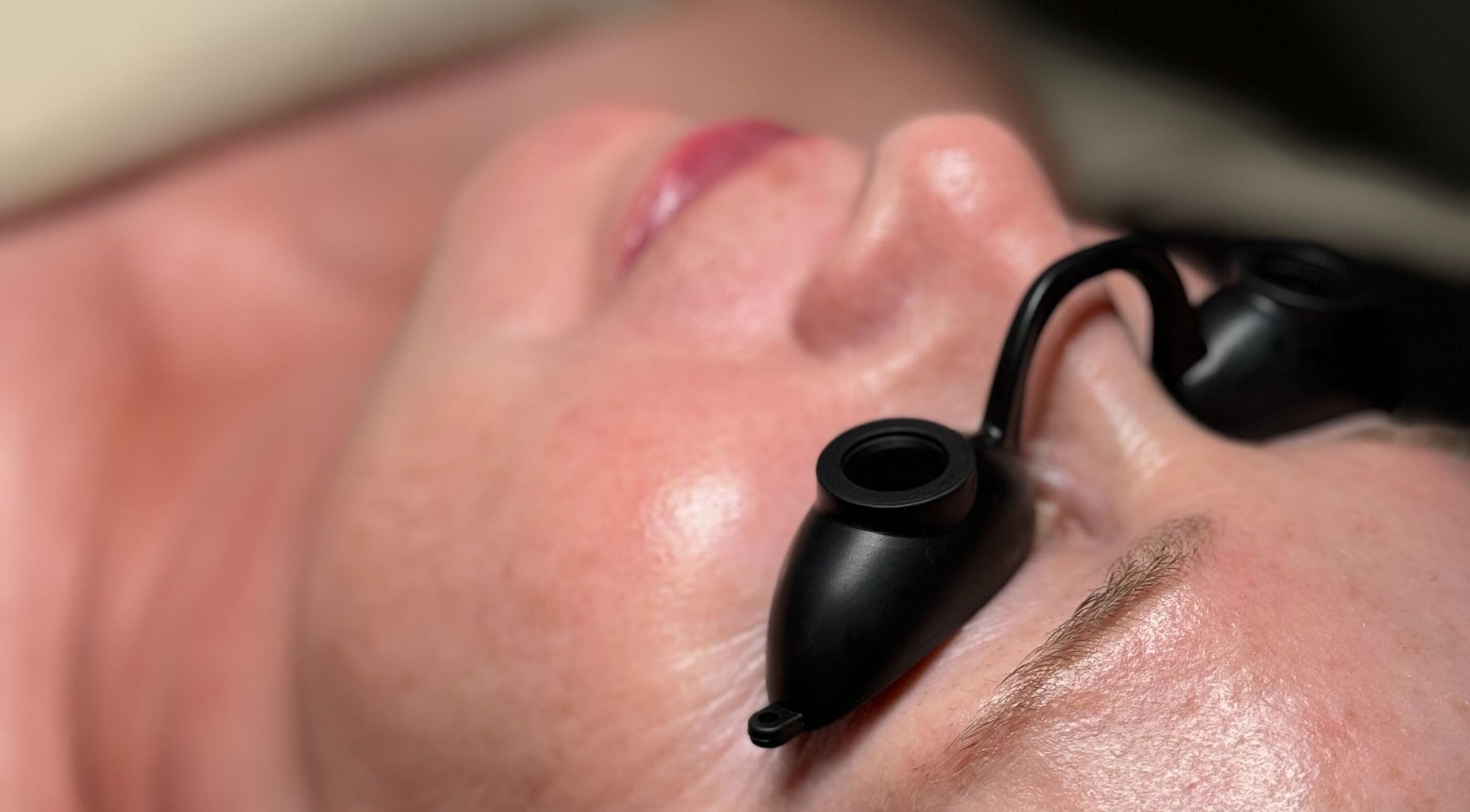 Facial treatment in progress at The Glow Box Aesthetics, West Allis, Wisconsin, US.