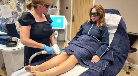 Professional laser procedure at Amanda’s skin and laser lounge in Chadderton, England, GB.