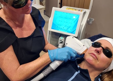 Laser treatment at Amanda’s Skin and Laser Lounge, Chadderton, England, GB, promoting radiant skin and wellness.