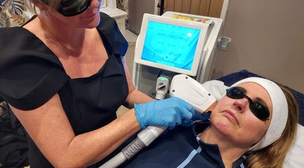 Laser treatment at Amanda’s Skin and Laser Lounge, Chadderton, England, GB, promoting radiant skin and wellness.
