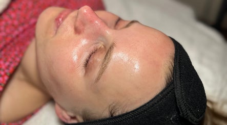 Glowing skin after a facial at BKlima Beauty, Basildon, England, GB, showcasing expert skincare results.