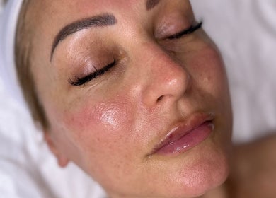 Close-up of a client's radiant skin after a facial at BKlima Beauty, Basildon, England, GB.