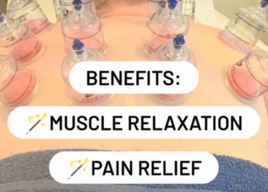 Cupping therapy session highlighting muscle relaxation and pain relief at Sharon Evans soft tissue therapy, Hereford, GB.