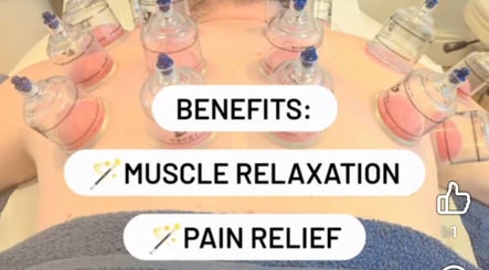 Cupping therapy session highlighting muscle relaxation and pain relief at Sharon Evans soft tissue therapy, Hereford, GB.