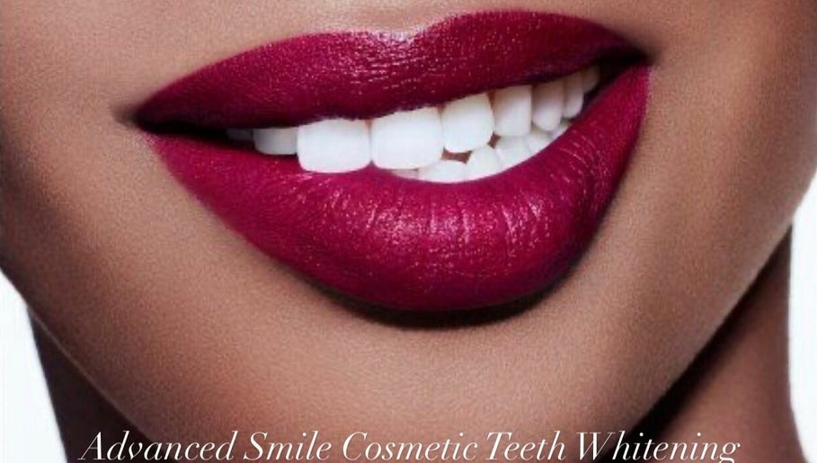 Advanced Smile Lab Cosmetic Teeth Whitening - Las Vegas image 1