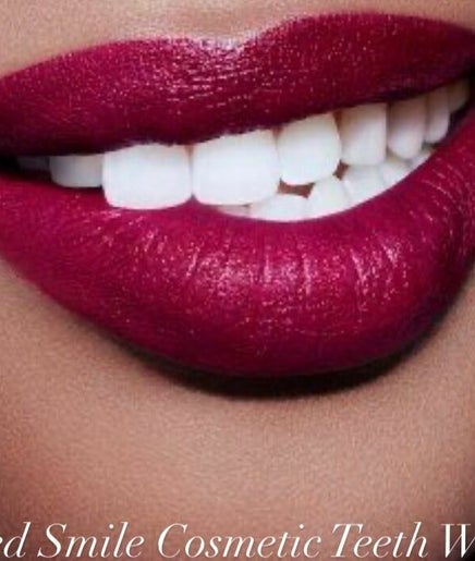 Advanced Smile Lab Cosmetic Teeth Whitening - Las Vegas image 2