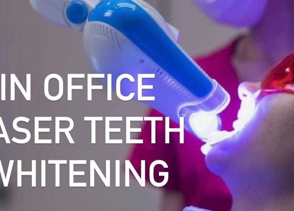 Advanced Smile Lab Cosmetic Teeth Whitening procedure in Taylor, Michigan, US showing laser treatment.