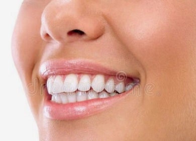 Bright smile after teeth whitening at Advanced Smile Lab Cosmetic Teeth Whitening in Taylor, Michigan, US.