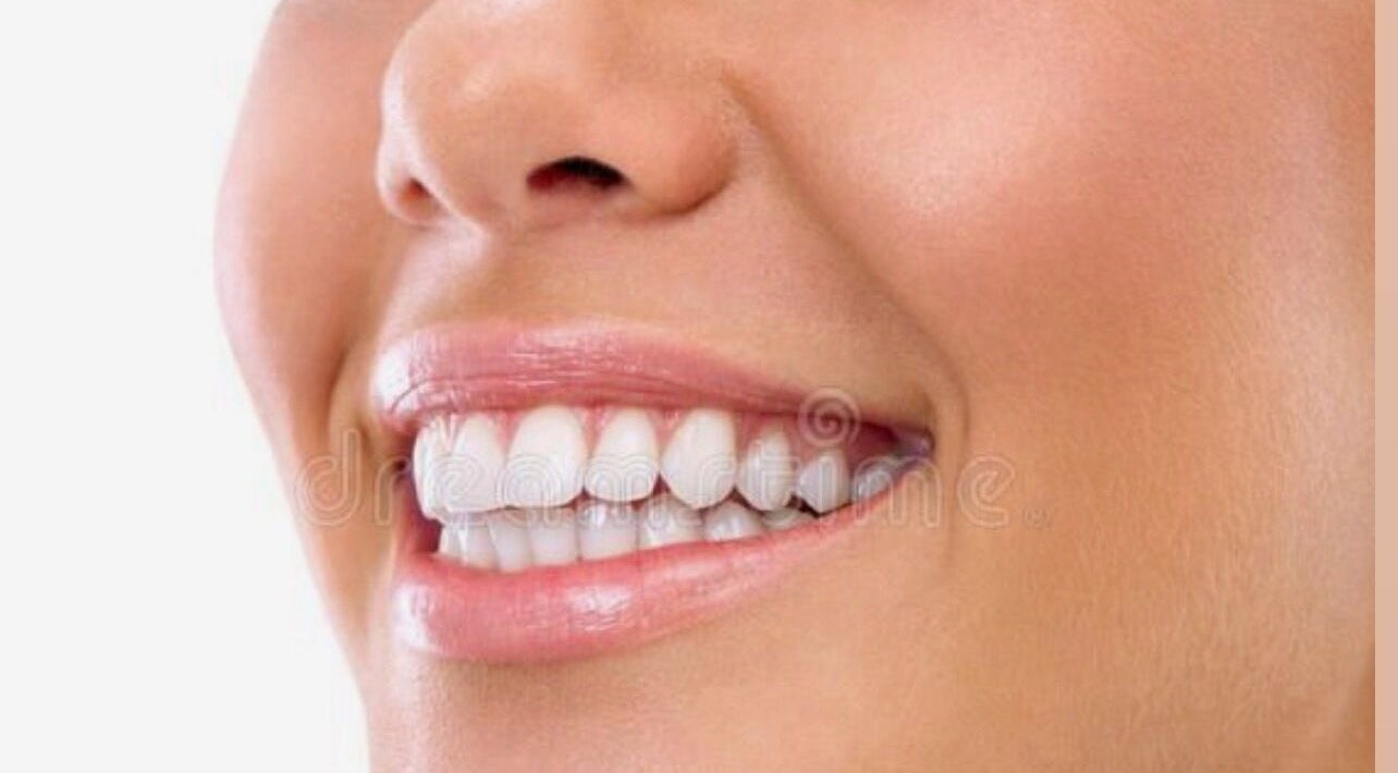 Bright smile after teeth whitening at Advanced Smile Lab Cosmetic Teeth Whitening in Taylor, Michigan, US.