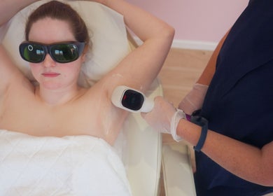 Laser hair removal session at DCA Laser Hair Removal Clinic in Birmingham, England, GB, ensuring smooth skin.