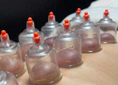 Cupping therapy at UNISS 2025 Auckland Netball Centre, Auckland, Auckland, NZ for wellness treatment.