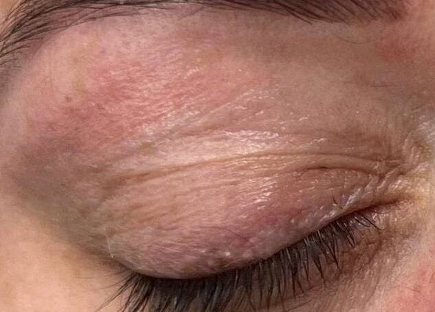 Close-up of a closed eyelid, showcasing skincare by Haven Hair Beauty & Aesthetics in Coventry, England, GB.