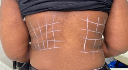 Noire Aesthetics Clinic, bilde 3