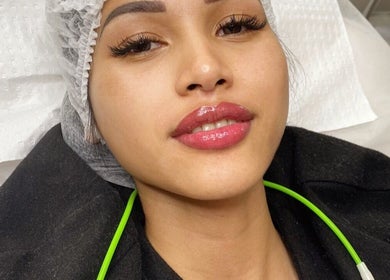 Client with enhanced lips at Envious Effects Cosmetic Tattoo - Southport, Queensland, AU.