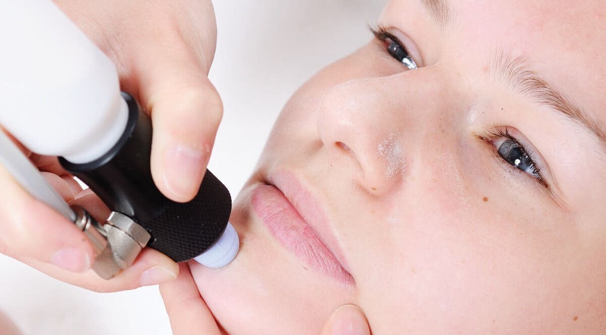 Facial treatment at Nadine Louise, Salisbury, England, GB, highlighting expert skin rejuvenation techniques.