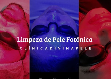 Tratamento de pele com luzes na Clínica Divina Pele em São José do Rio Preto, São Paulo, BR.