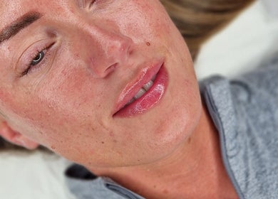 Close-up of a woman's face showcasing smooth skin after a facial at Nura Skin, Dudley, England, GB.