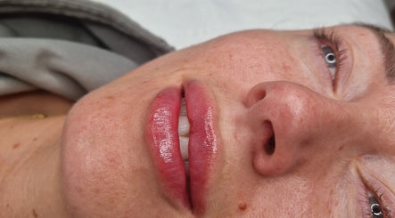 Close-up of a client's smooth, healthy skin after treatment at Nura Skin, Dudley, England, GB.
